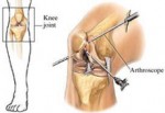 knee-surgery